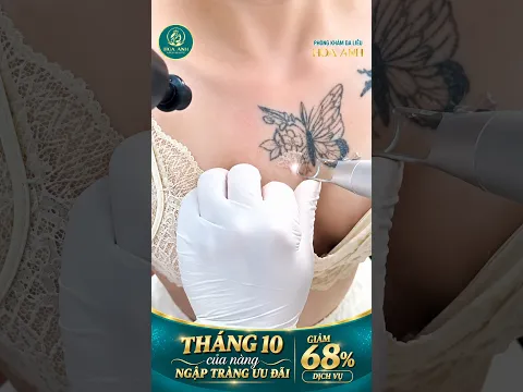 Tại sao khách hàng tin chọn xóa hình xăm tại Hoa Anh| Đào Ngọc Anh { Thẩm Mỹ }