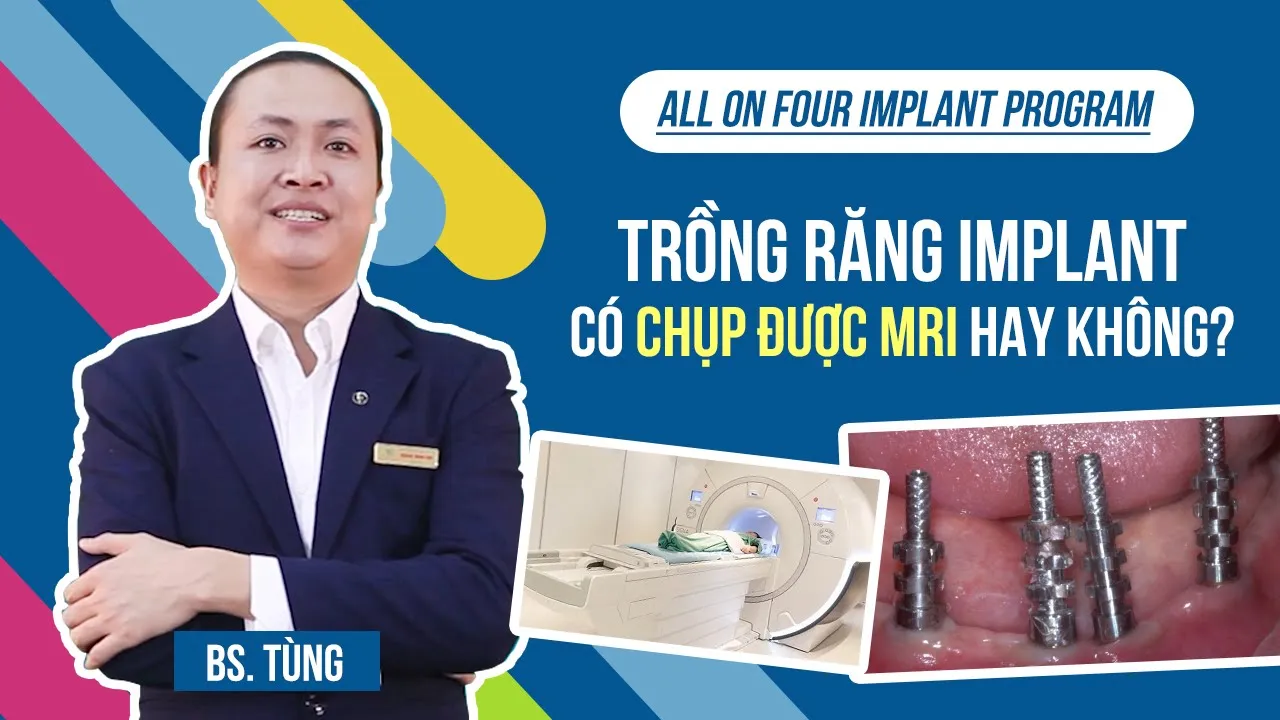 Outline Video Trồng răng giả Implant có chụp được phim x-quang cộng hưởng từ MRI hay không?