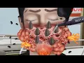 Download Lagu ASMR LIVE ANIMATION TREATMENT
