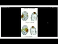 EEG based Brain-Computer Interface for control of a robotic manipulator through motor imagery
