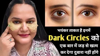 आंखों के काले घेरे / डार्क सर्कल्स का घरेलू इलाज || Dark Circles Treatment #darkcircles #skincare