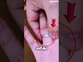 Download Lagu Jangan panik jika cincin nyangkut di jarimu‼️😱 #shorts #short #trending #viral
