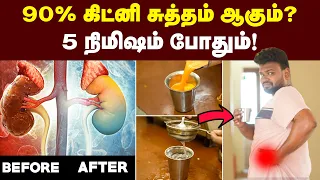 வாரம் இரு முறை குடிச்சா போதும்  stone கவலையில்லாமல் வாழலாம் 🥳 | Kidney Stone Prevention🙌🏻