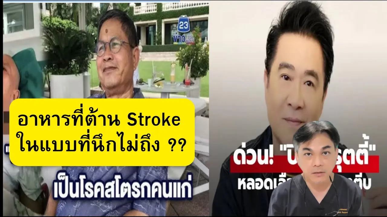 คนดังกับโรค :  Stroke ในคนสูงวัย กับ อาหารต้าน Stroke ที่หลายคนนึกไม่ถึง ?