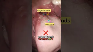 Jeebh Ke Pichhe Laal Daane Kya Hai Tastebuds Tongue 