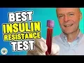 Download Lagu Insulin Resistance Test (Best Test for IR \u0026 Stubborn Weight Loss) Homa-IR