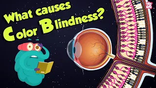 What Causes Color Blindness WhatIs COLOR BLINDNESS Dr Binocs Show Peekaboo Kidz 
