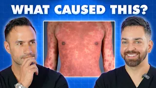 We Put Dermatology Residents to the Test for $60,000 | Introducing Doctorly Games