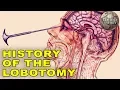 Download Lagu Walter Jackson Freeman II The Champion Of The Lobotomy
