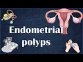 Endometrial Uterine Polyps - Everything You Need To Know