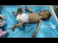 Download Lagu Bayi Palestina Melawan Kelaparan