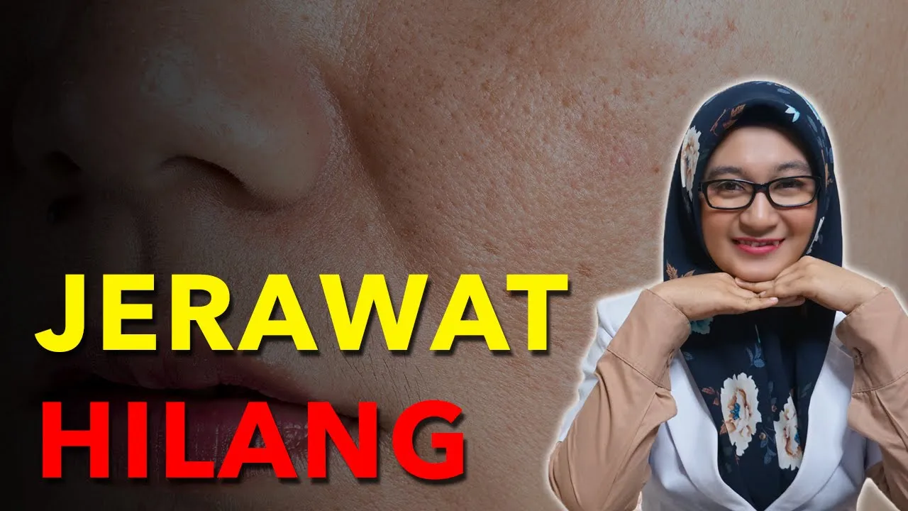 
          
          
          
            
            Cara Menghilangkan #Jerawat Secara Alami Yang Aman Untuk Remaja
          
        . 