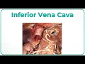 Inferior Vena Cava Where Surgeons Go Wrong Step 1