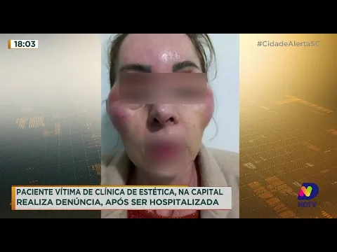 Florianópolis: paciente vítima de clínica de estética realiza denúncia após ser hospitalizada