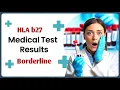 Download Lagu HLA-B27 test क्या होता है II Borderline HLAB27 Test मतलब क्या