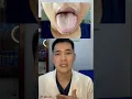 Lagu Sắc Lưỡi Trắng Dấu Hiệu Cơ Thể Mắc Nhiều Bệnh | Bác Sĩ Tiến