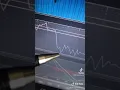 How to Use RSI and MACD for Options Trading