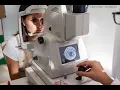 Fluorescein angioscopy CPT code - simplify medical coding