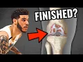 Is Lonzo Ball s Career OVER Doctor Explains Cartilage Transplant