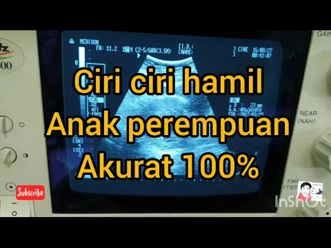 Download MP3 9 Ciri-ciri Hamil Anak Perempuan yang akurat 100%