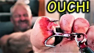 SAILING FISHING FAIL – surgery off remote islands Ep 48