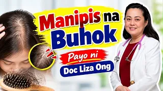 Manipis na Buhok. Payo ni Doc Liza Ong