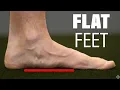 You Don t Need To Fix Your Flat or Pronated Feet