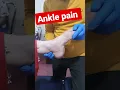 Download Lagu Ankle pain treatment 😪