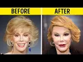 50 Celebrity Plastic Surgery Disasters Before and After