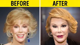 50 Celebrity Plastic Surgery Disasters Before and After