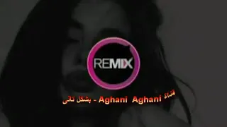 رنت كردانك   دندنها