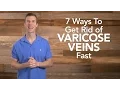 7 Ways to Get Rid of Varicose Veins Fast Dr Josh Axe