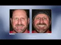 Replacing Missing Teeth with Dental Implants Melanie Towe DMD Frederick MD Periodontist
