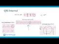 Cardiology Step 2-3 ACLS and Tachycardias Boards and Beyond
