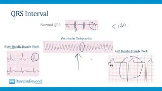 Cardiology Step 2-3 ACLS and Tachycardias Boards and Beyond