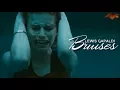 Lewis Capaldi-Bruises Traducida al Espanol