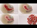 Management of Postpartum Hemorrhage PPH Etiologies prevention treatment TVASurg