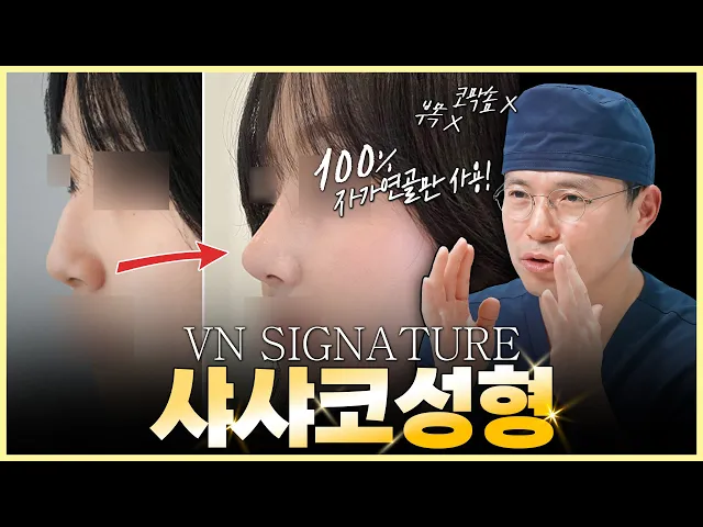 무보형물코성형 브이엔 시그니처 샤샤코 (연골입자,비개방코성형)