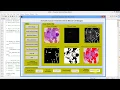 Leukemia Blood Cancer Detection from Blood Cells Using Image Processing Matlab Project