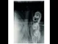 Download Lagu Zoviet France - Assault and Mirage [Vinyl]