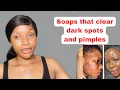 Download Lagu 3 Best Soaps for Pimples \u0026 Dark Spots | Clear \u0026 Glowing Skin