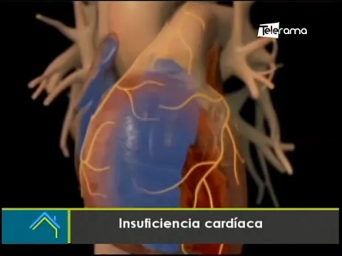 Insuficiencia cardíaca