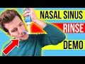 How to do a NASAL SINUS washout at home Doctor demonstrates