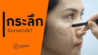  การทำเลเซอร์เพื่อรักษารอยดำลึกมีผลข้างเคียงหรือไม่ 