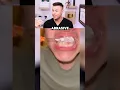 Download Lagu Is This The ULTIMATE Teeth Whitening Routine?! 😬🦷