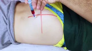 حقنه عضلB12فيتامينات لتقويه الأعصاب تعلم اعطاء الحقن العضل Intramuscular Injection Of Vitamins B12 