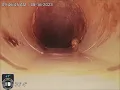 Carlton Arms - View Inspection of Main Sewer Line