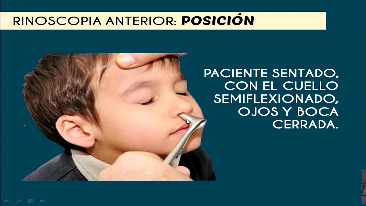 Exploración semiológica del I Nervio Craneal (Olfatorio)