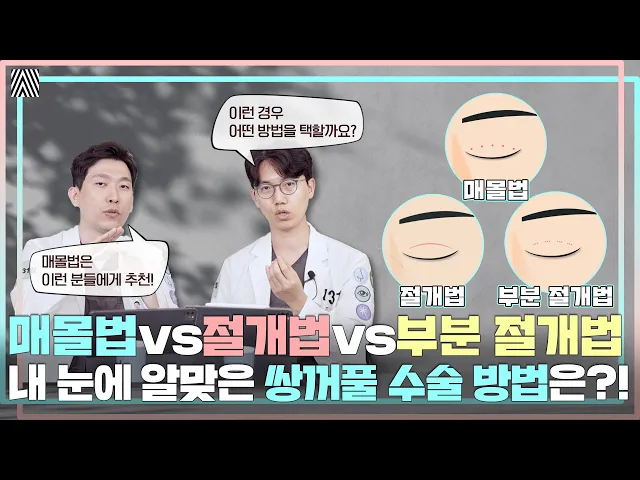 매몰vs절개vs부분 절개 내 눈에는 어떤 방법이 최선일지 알려드립니다! 쌍꺼풀 수술 1편!_[4월31일 성형외과]