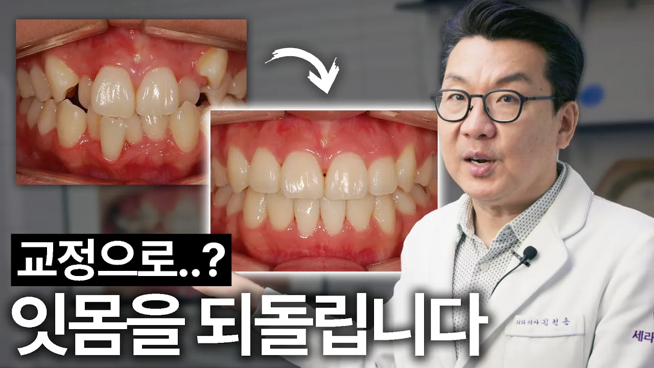 잇몸을 되살리는 치아 교정이 어떻게 가능한 걸까